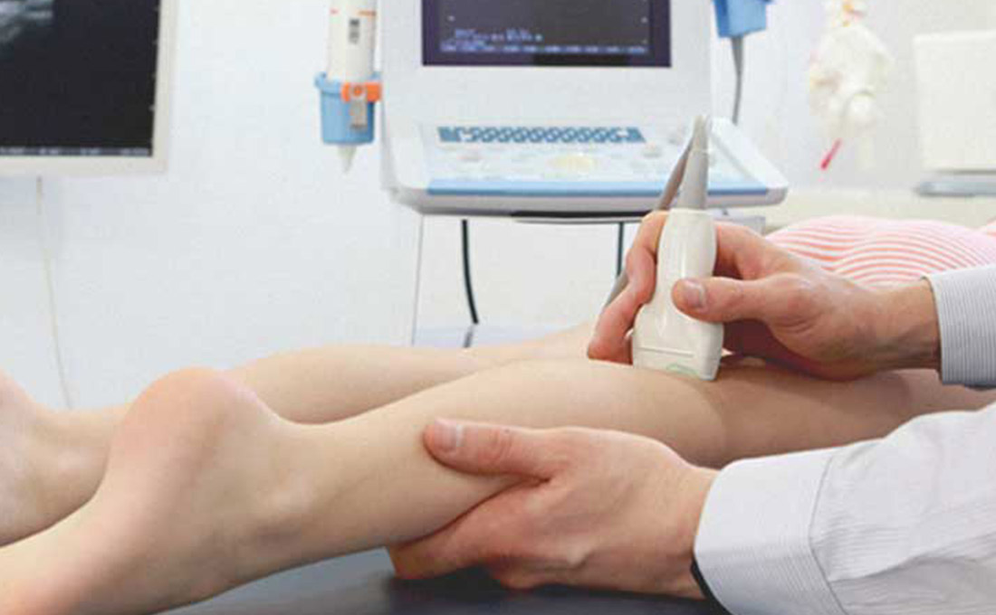 ecografie vasculara - skinmed clinic