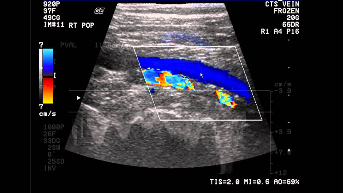 ecografia abdominala vasculara - skinmed clinic
