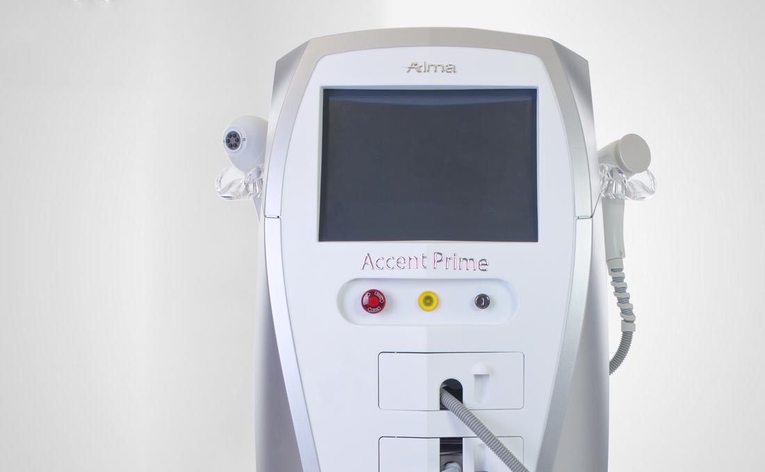 Accent Prime produs de Alma Lasers - skinmed clinic
